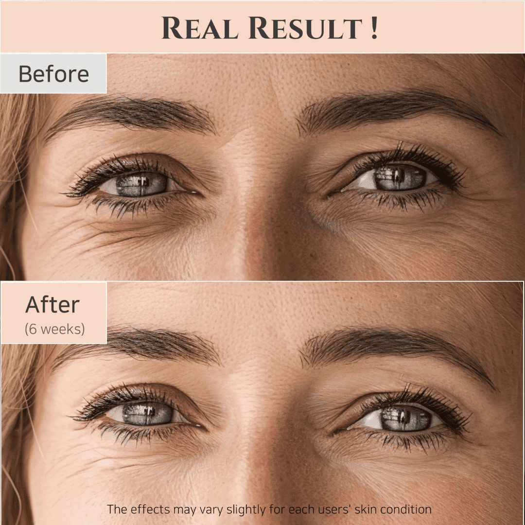 Beauty of Joseon | Revive Eye Serum for Puffy Eye Bags